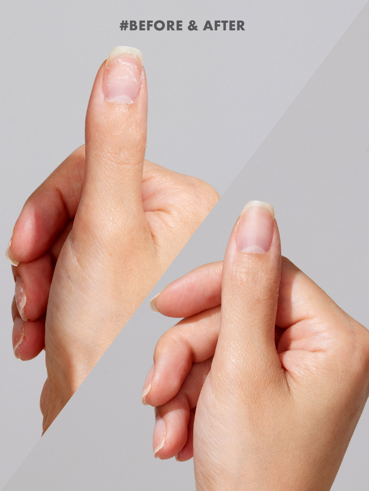 UMCARE01_Magical_Nail_Solution_1